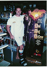 Dave with a defective leg.